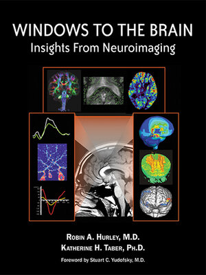 cover image of Windows to the Brain